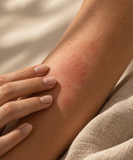 Trattamento lenitivo per pelle del corpo arrossata